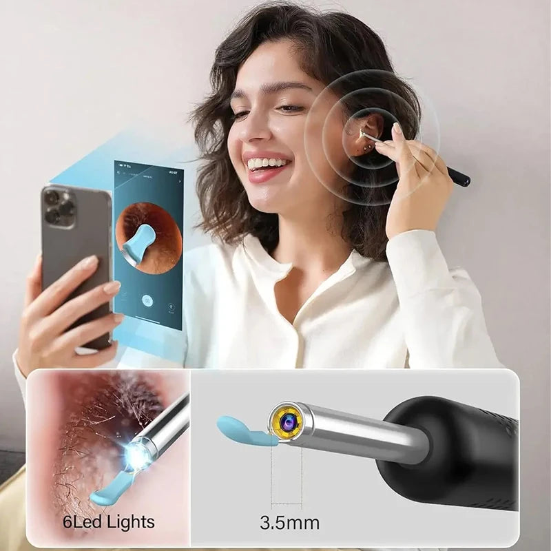Limpiador de oidos, otoscopio, cámara wifi, accesorios GRATIS, luz led